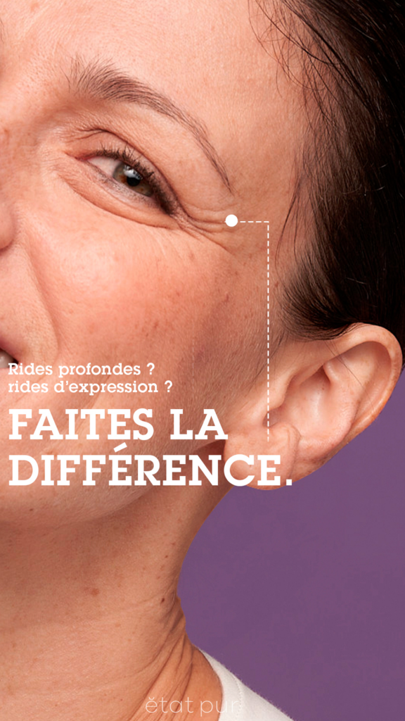 Image à la une de l'article Lancer la DNVB de NAOS sur les réseaux